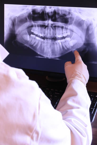 Best Emergency Dentist for Knocked-Out Tooth in Lake Odessa, MI
