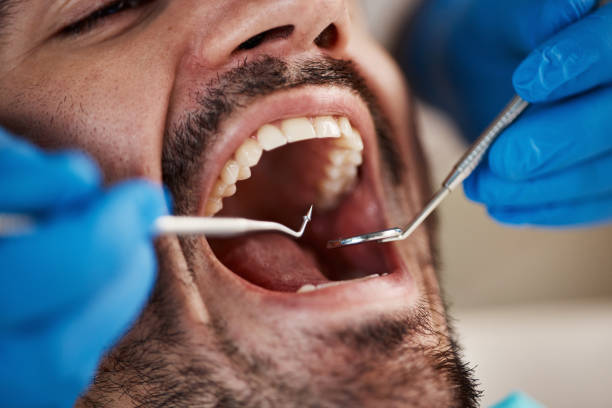 Best Emergency Dental Care for Abscessed Tooth in Lake Odessa, MI