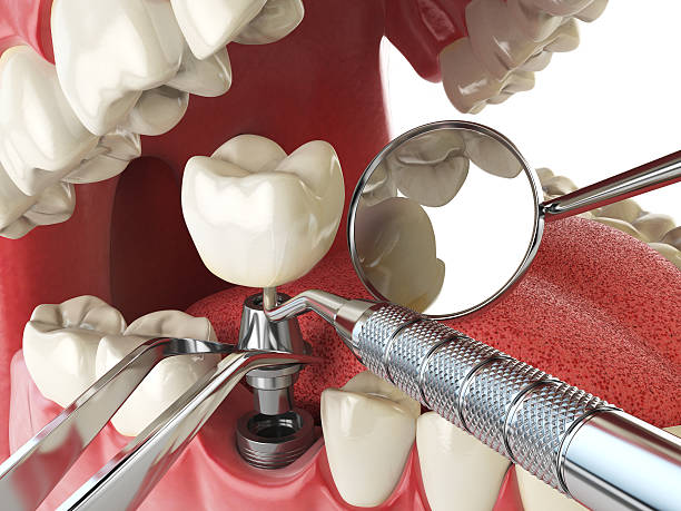 Best Mobile Emergency Dentist in Lake Odessa, MI